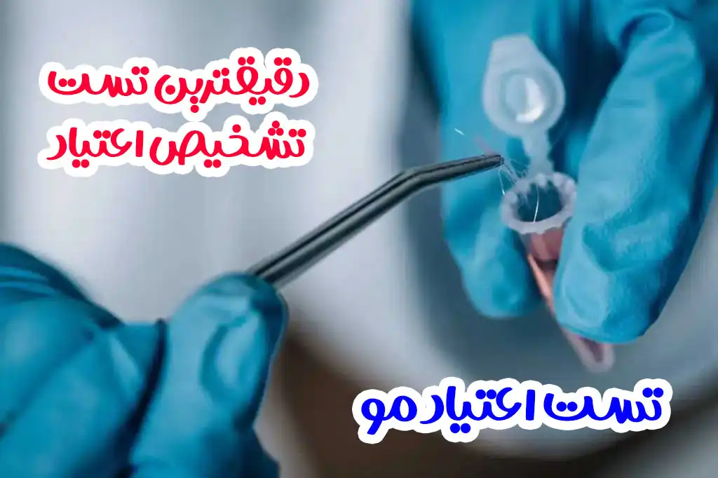 آزمایش مو دقیقترین آزمایش اعتیاد